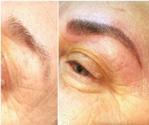 Microblading patient 6 before and after pictures