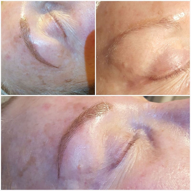 Microblading patient 3 before and after pictures