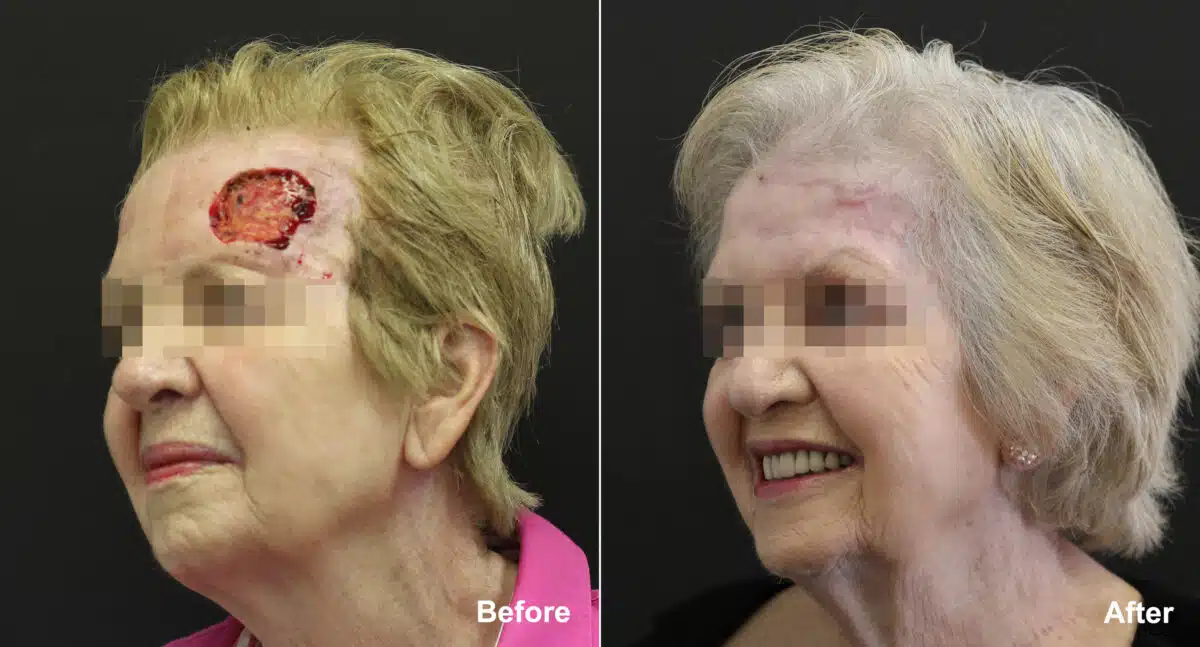 Reconstructive Surgery Before and After Photos in Princeton, NJ, Patient 9834