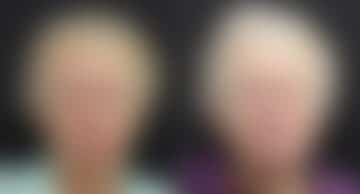 Reconstructive Surgery Before and After Photos in Princeton, NJ, Patient 9830