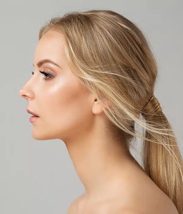 The results of rhinoplasty are permanent, although subsequent injury or other factors can alter the nose's appearance.