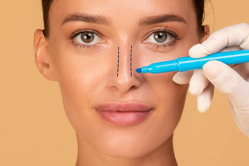 The closed rhinoplasty procedure generally takes about one to two hours, depending on the complexity of your desired outcome