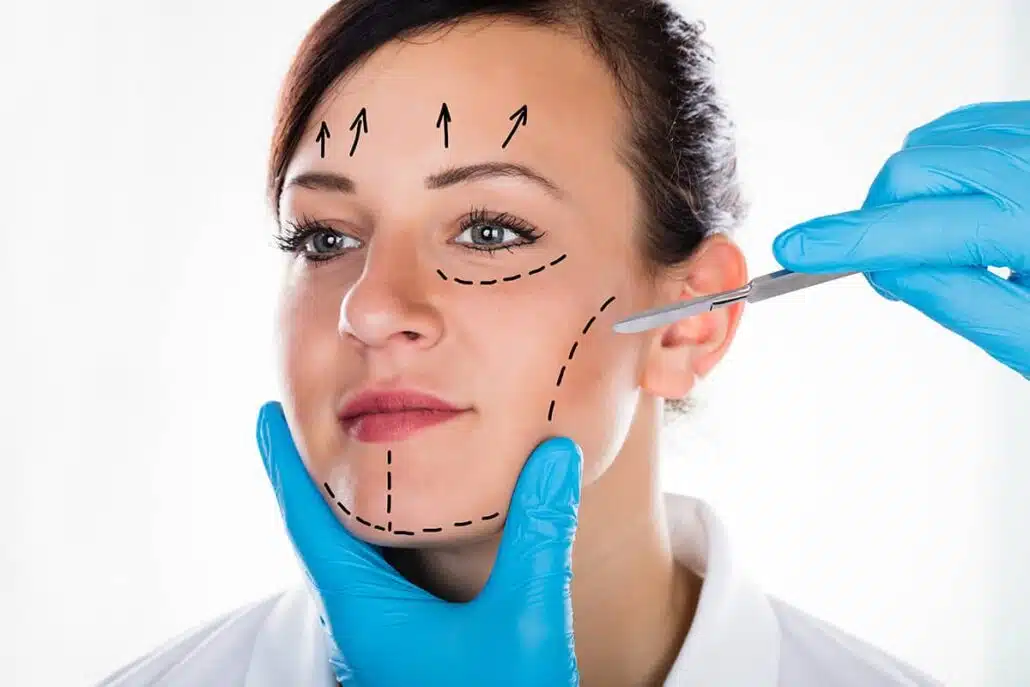 The appearance of facelift scars can be minimized by following post-operative wound care instructions, including keeping the area clean and dry, avoiding direct sun exposure, and using silicone gel or scar cream