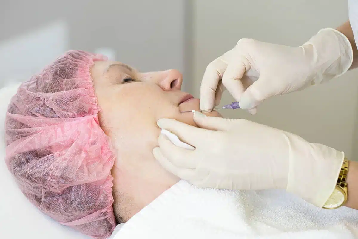 Other factors that can affect the cost include the practitioner's experience, geographic location, and choice of products used in the procedure
