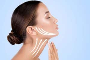 Neck lift surgery carries the risk of infection, scarring, nerve damage, and other complications