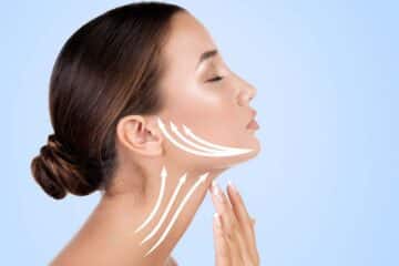 How to Avoid a Botched Neck Lift: Expert Tips and Advice