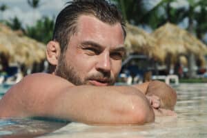 A male otoplasty patient in a pool with Cauliflower ear.