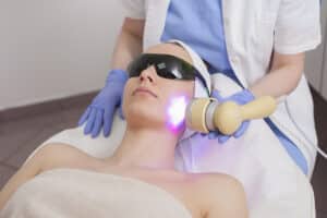 Female patient receiving an IPL treatment and not worriying about side effects.