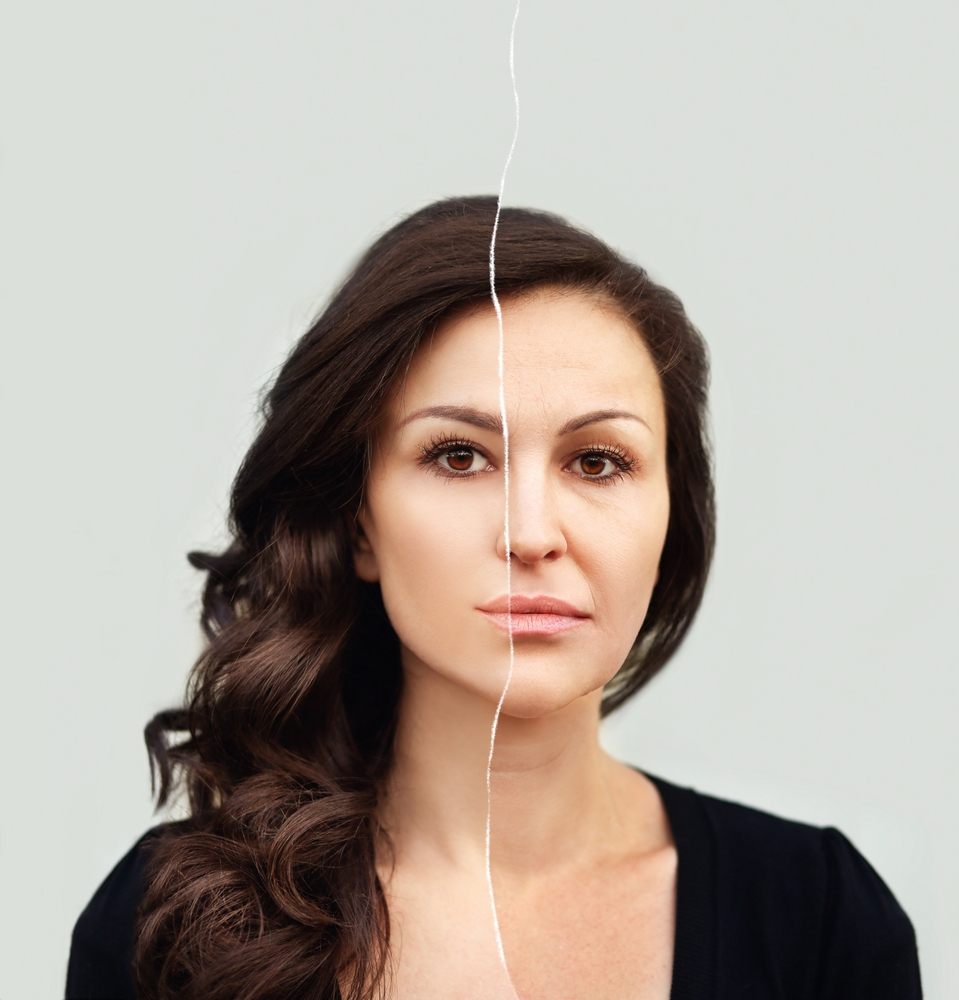 Split image of a woman’s face showing visual comparison of aging effects with and without early Botox intervention