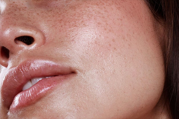 Close-up of facial skin and jawline illustrating age-related bone changes affecting facial support and shape.