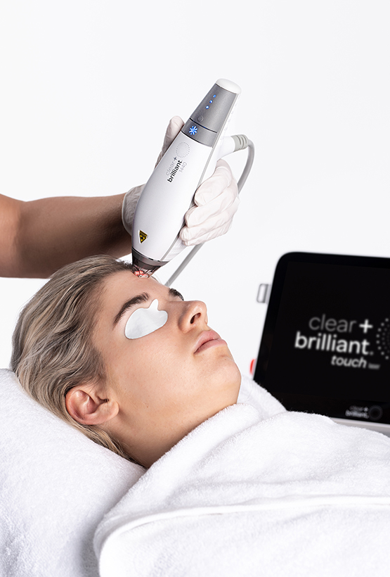 Clear + Brilliant laser device applied to patient’s forehead during treatment, illustrating minimal downtime skin resurfacing procedure.