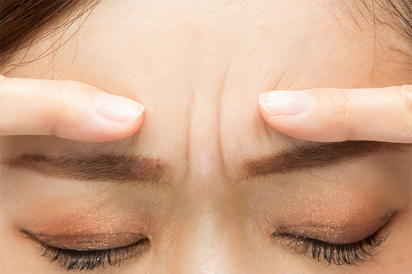 Close-up of frown lines between eyebrows showing targeted Botox treatment area for smoother forehead skin.