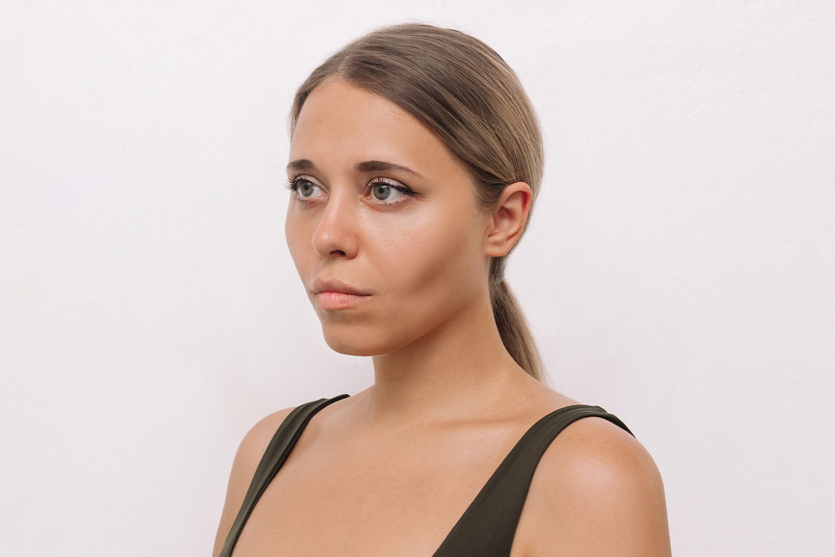 Woman with sculpted cheeks and defined facial contours illustrating benefits of buccal fat removal.