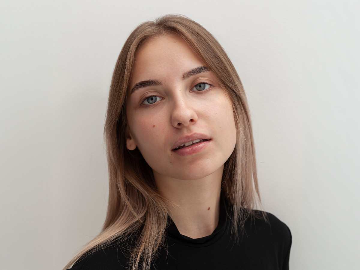 Woman with naturally contoured cheeks illustrating refined facial structure after buccal fat removal.