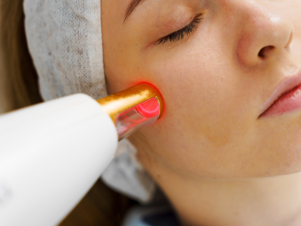 Close-up of IPL device emitting light pulses on cheek during non-invasive skin rejuvenation treatment