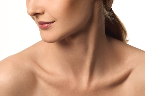 Defined chin and jawline after submental liposuction reducing excess fat under the chin area.