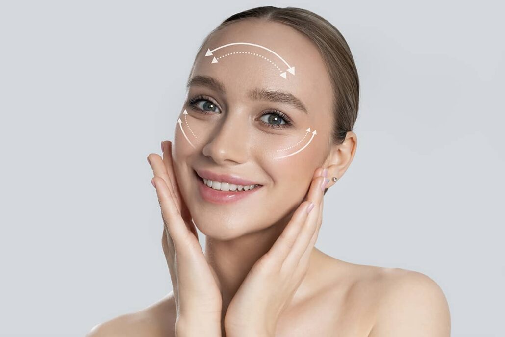 A smiling woman with white directional arrows and dotted lines on her forehead and cheeks illustrating the vectors of a facial lift.