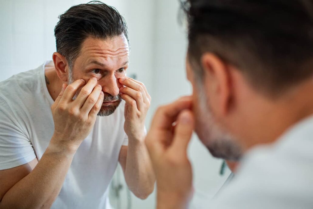 A man with a beard looking intently into a bathroom mirror while using his fingers to assess the volume and puffiness under his eyes.