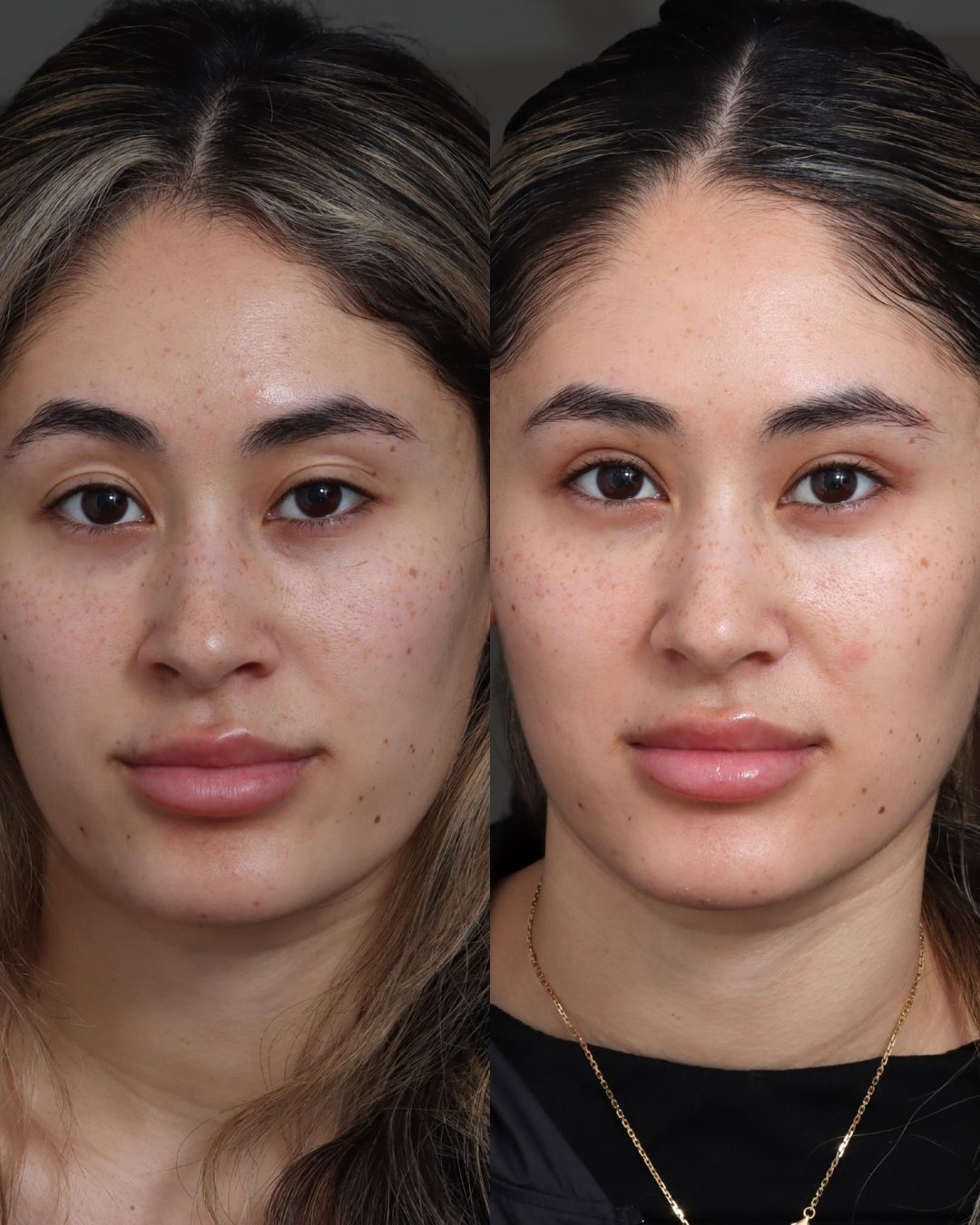 Dr Schrader Before/Afters - 8