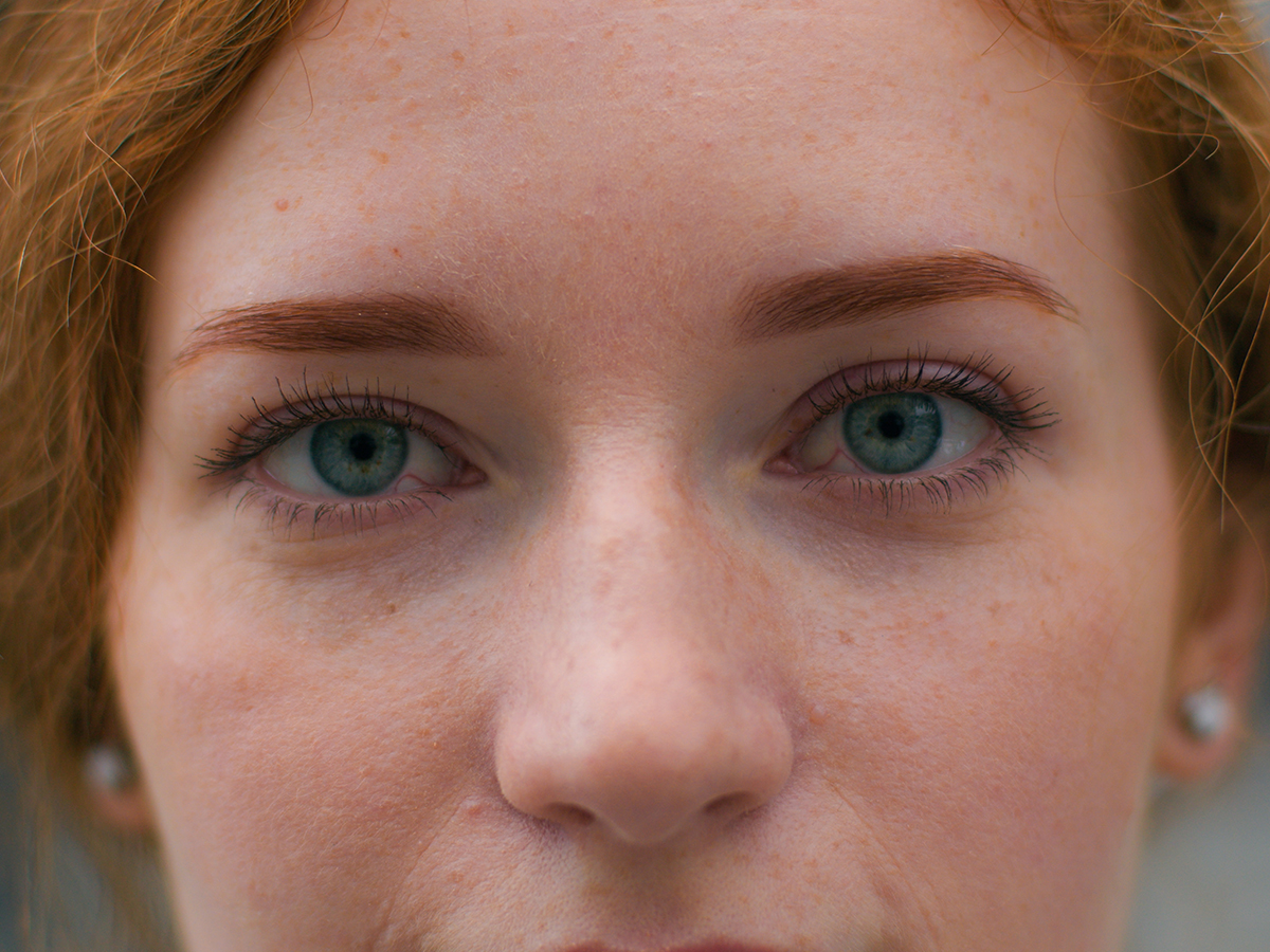 Close-up of eyes showing eyelids for blepharoplasty and eyelid surgery information.